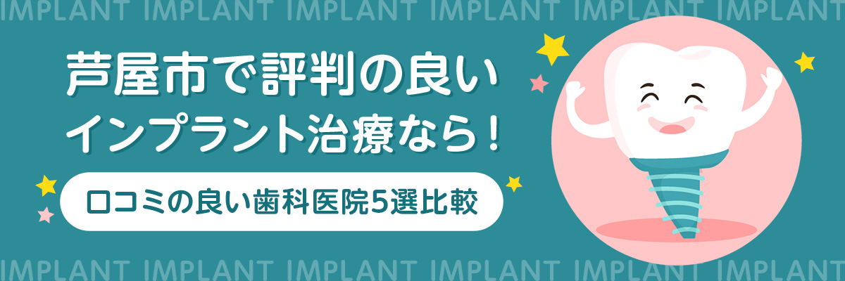 芦屋市で評判の良いインプラント治療なら！口コミの良い歯科医院5選比較